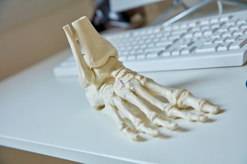 Bunion assessment 5 Supafoot 0F7A3645