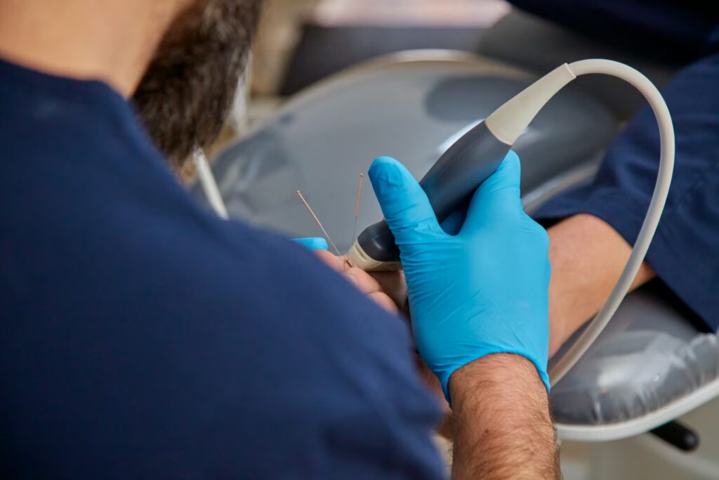 Dry needling / Acupuncture 2 Supafoot 0F7A3658