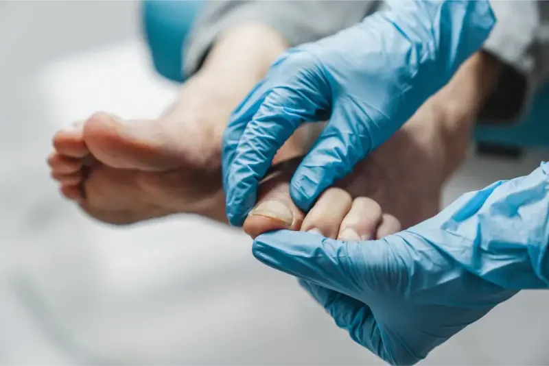 Nail surgery 4 podiatrist treating feet during procedure 2025 01 09 05 16 04 utc